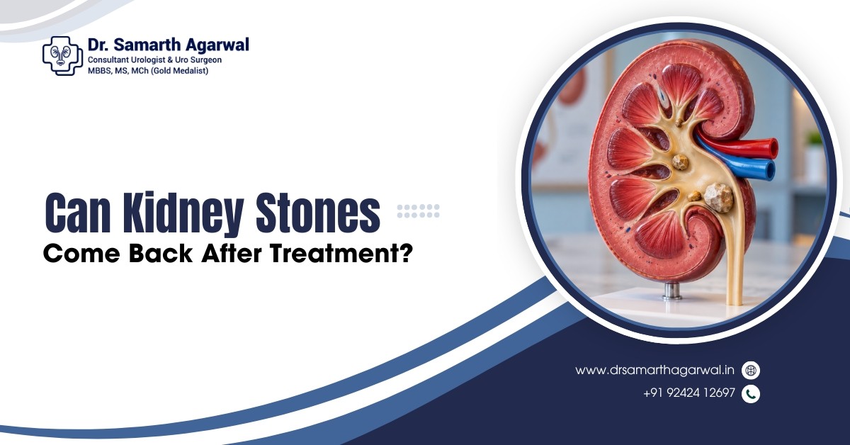 Can Kidney Stones Come Back After Treatment?