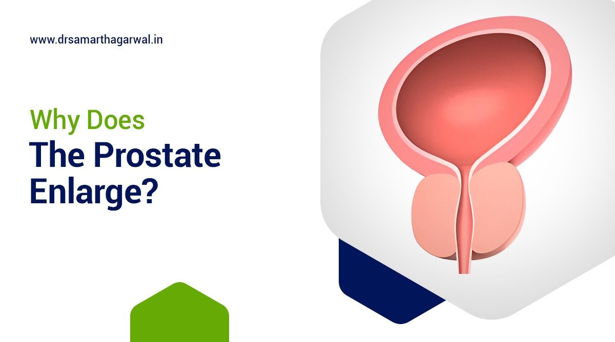 Why Does The Prostate Enlarge?