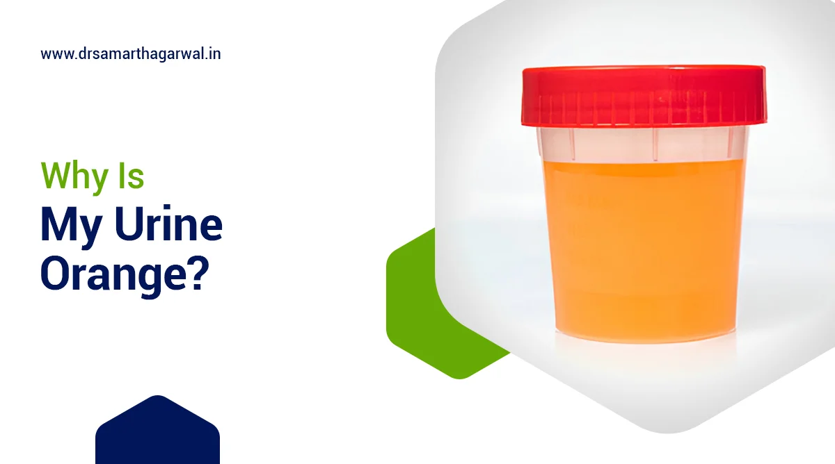 Why Is My Urine Orange?
