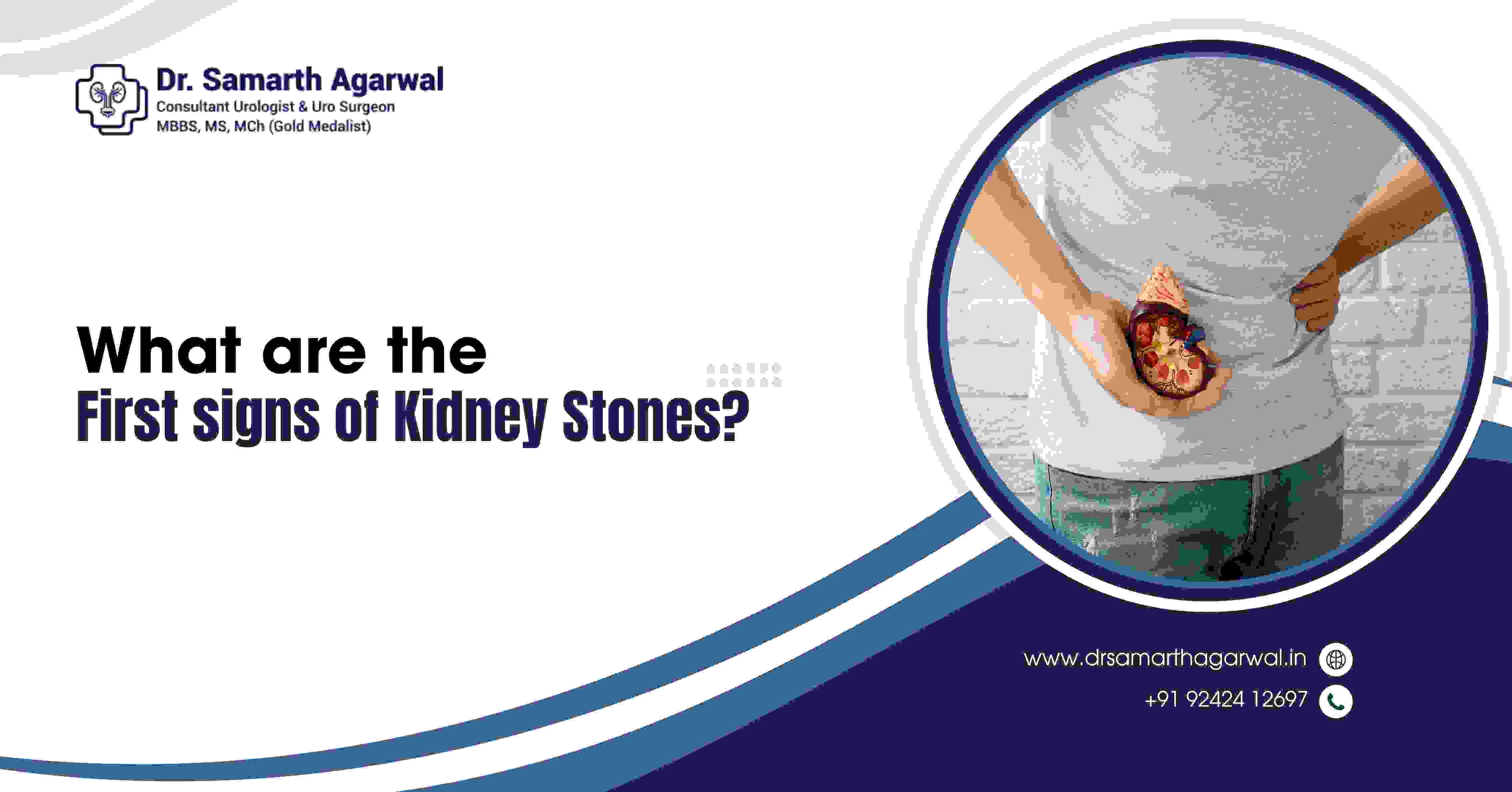 What are the First Signs of Kidney Stones?