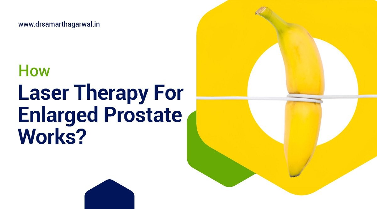 How Laser Therapy for Enlarged Prostate Works