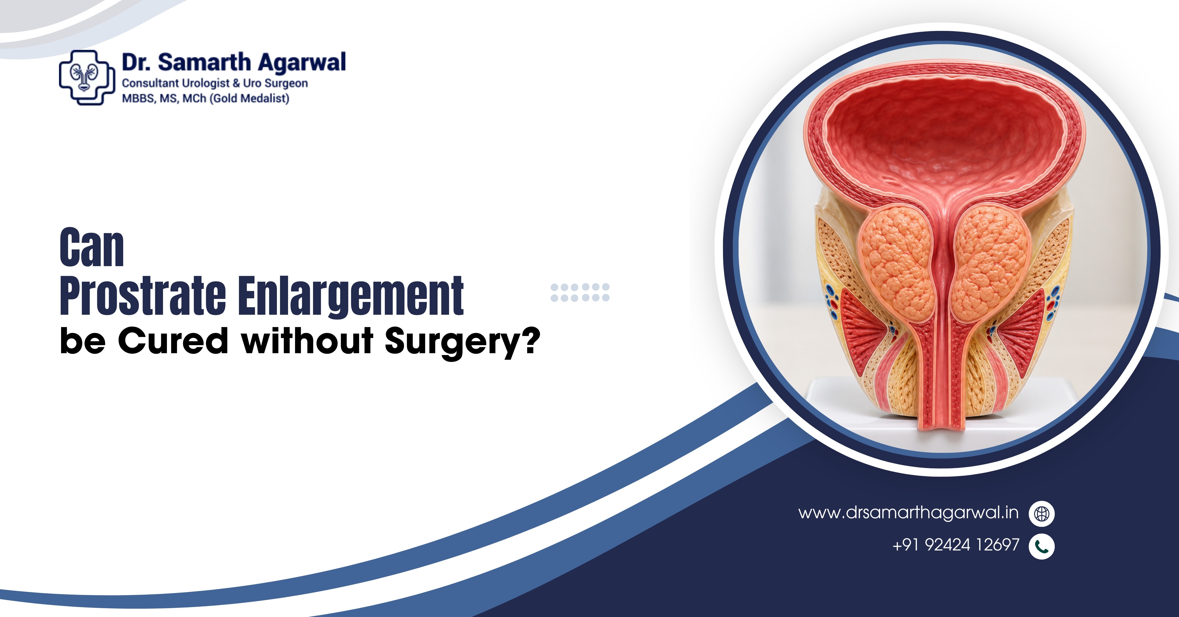 Can Prostate Enlargement be Cured without Surgery?