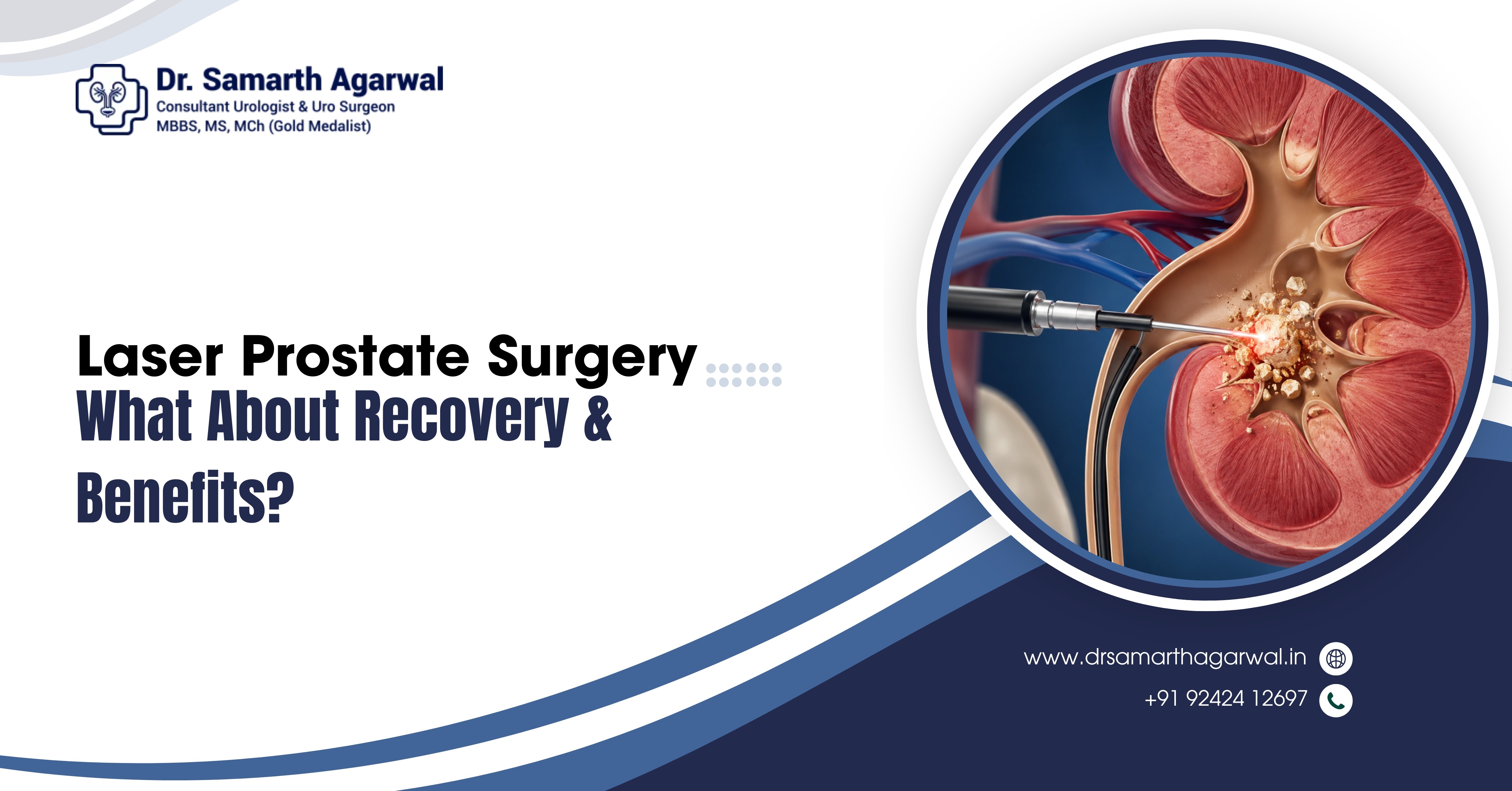 Laser Treatment for Kidney Stones: Is It Right for You?