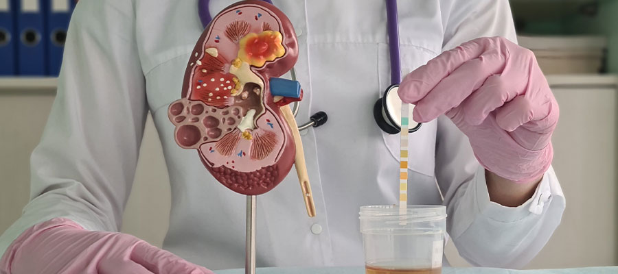 Kidney Stone Surgery in Siliguri