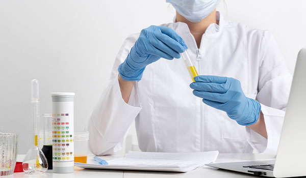 Lipid Profile Test
