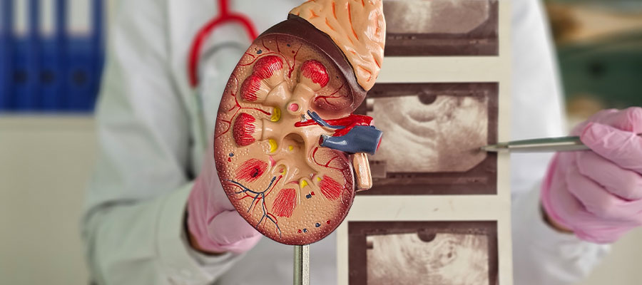 Recovery After Kidney Stone Surgery