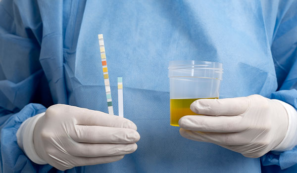 Urine Culture