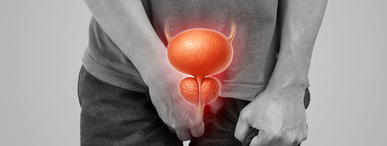 Enlarged Prostate