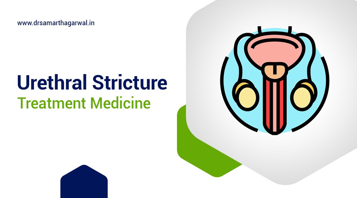 Can You Do Urethral Stricture Treatment with Medicine?