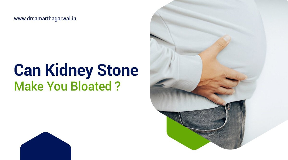 Can Kidney Stones Make You Bloated?