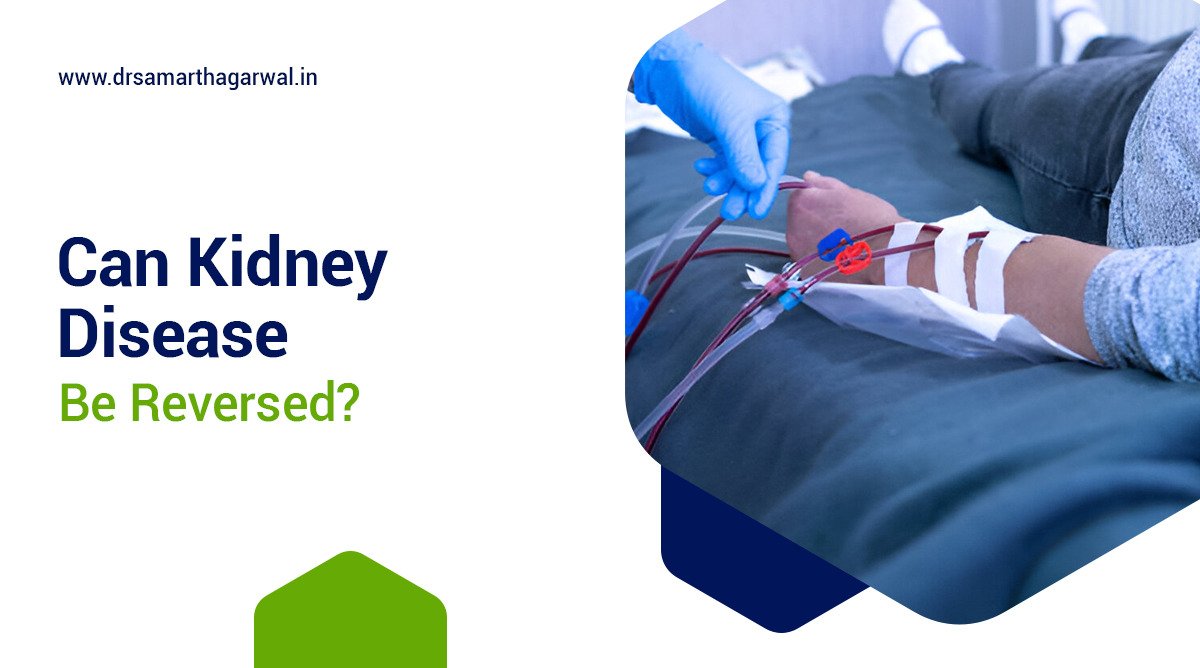 Can Kidney Disease Be Reversed